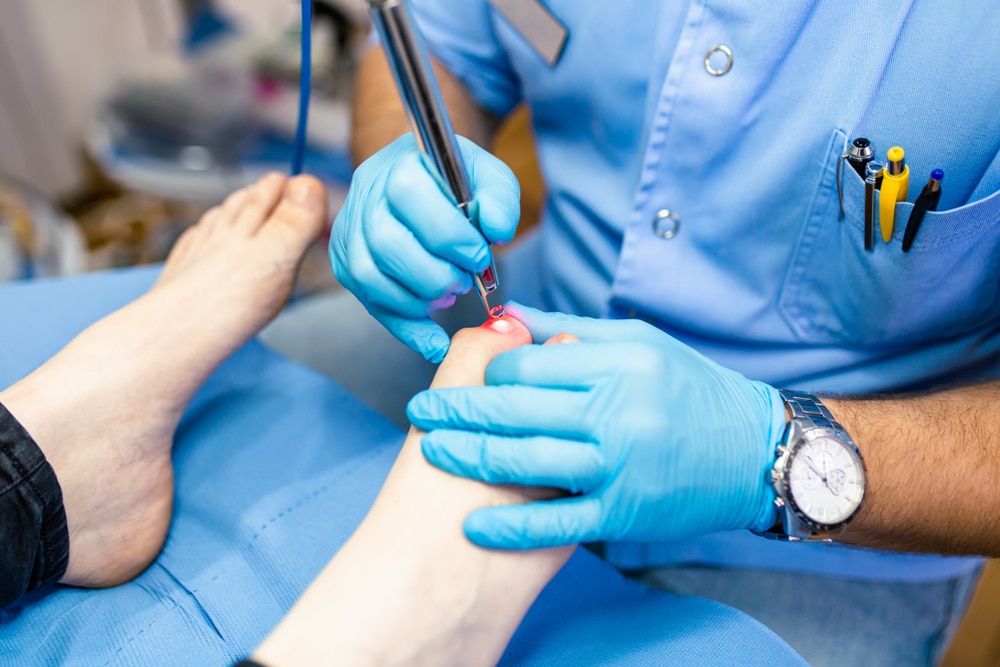 Toenail,Fungus,Treatment,With,Foot,Laser,At,Laser,Nail,Therapy Laser Nail Fungus Removal Milledgeville GA